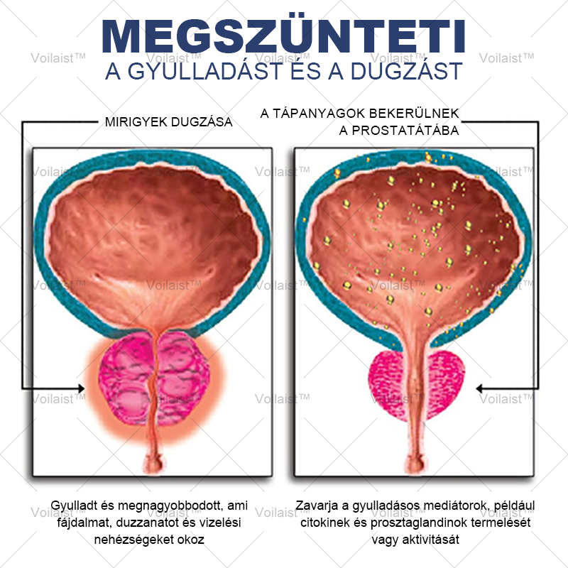 🚀 Voilaist™ Szuper Méh Prostata Egészségügyi Orrspray