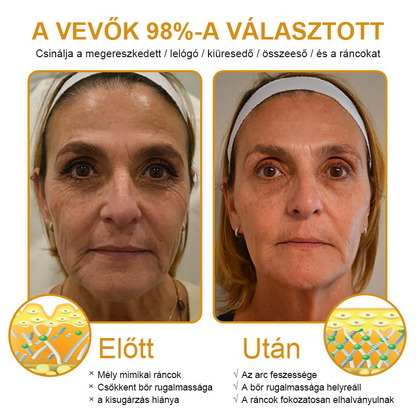 🏵️【Hivatalos Márkabolt】FRISSARC™ Botox Méhméreg Ránctalanító Krém