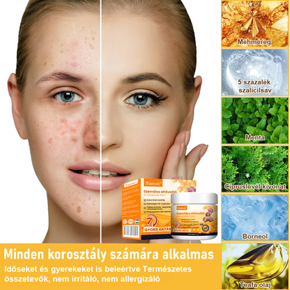🌼GŐYUIŐ™ Szemölcs eltávolító és halványító krém🍯 4-6 héten belül teljesen eltávolítja a bőrcímkéket, szemölcsöket, pattanásokat és bőrpírt, klinikailag igazolt👩🏼‍⚕️ (Bőrgyógyászok erősen ajánlják)
