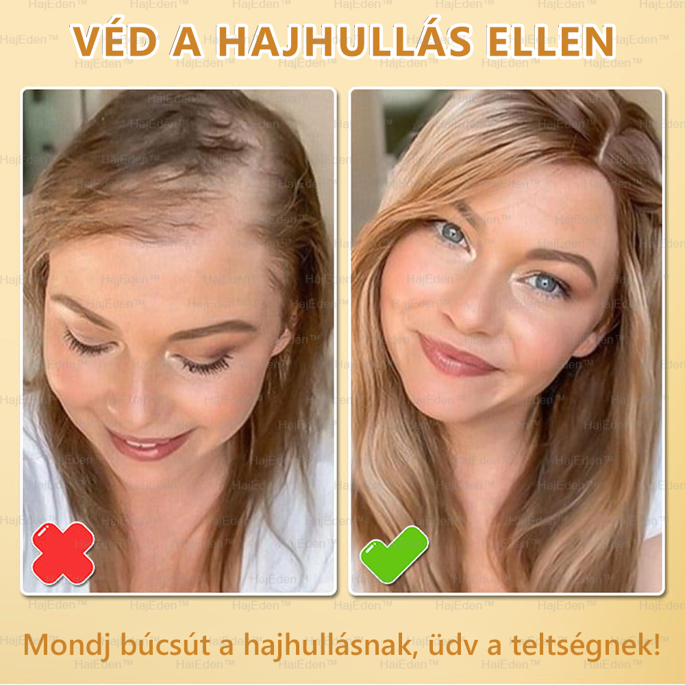 🌞 HajÉden™ BIOTIN HAJNÖVEKEDÉS SZÉRUM