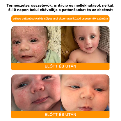 🌼GŐYUIŐ™ Szemölcs eltávolító és halványító krém🍯 4-6 héten belül teljesen eltávolítja a bőrcímkéket, szemölcsöket, pattanásokat és bőrpírt, klinikailag igazolt👩🏼‍⚕️ (Bőrgyógyászok erősen ajánlják)