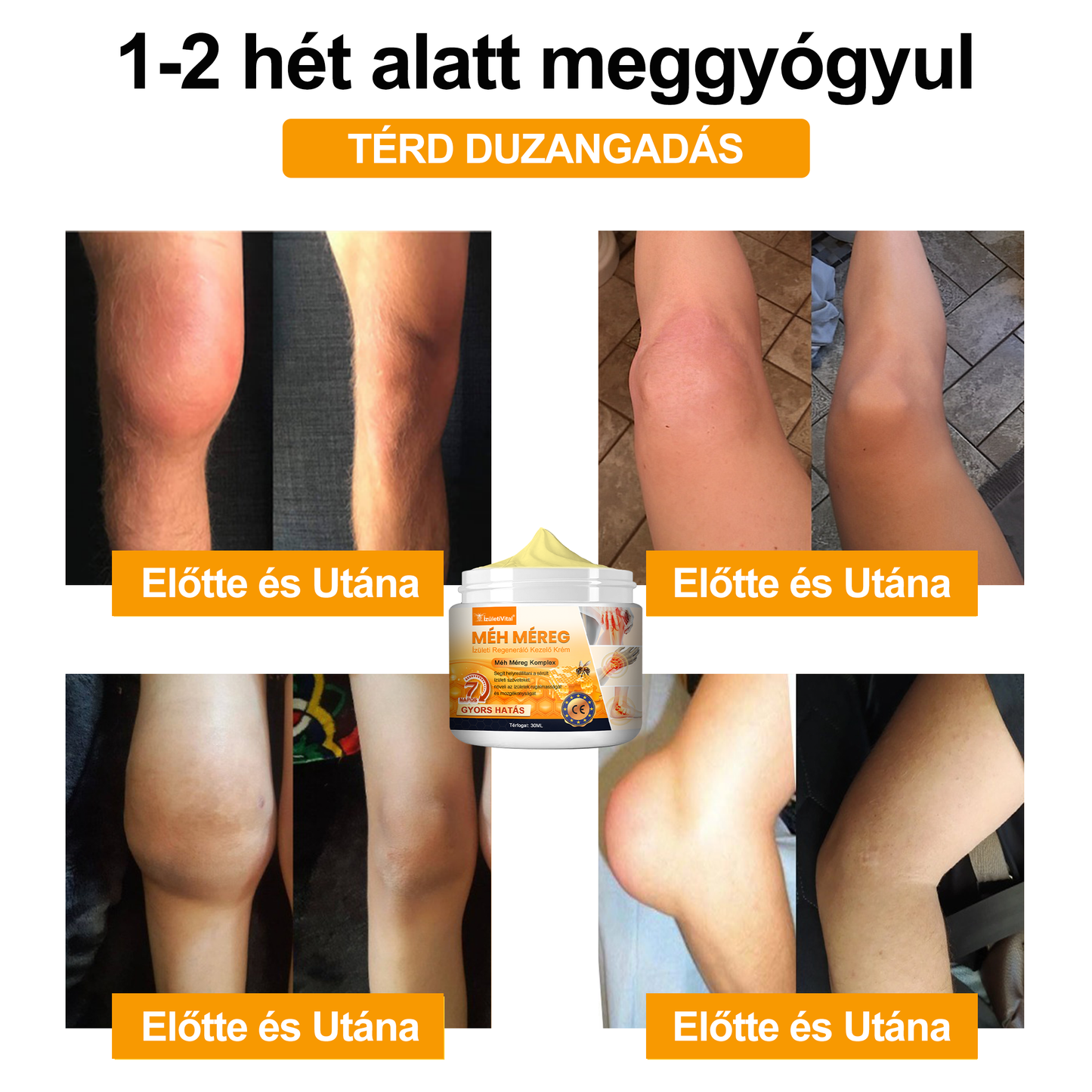 🐝🔥𝐈𝐳𝐮̈𝐥𝐞𝐭𝐢𝐕𝐢𝐭𝐚𝐥™ 𝐌𝐞́𝐡 𝐌𝐞́𝐫𝐞𝐠 𝐈𝐳𝐮̈𝐥𝐞𝐭𝐢 𝐑𝐞𝐠𝐞𝐧𝐞𝐫𝐚́𝐥𝐨 𝐊𝐞𝐳𝐞𝐥𝐨̋ 𝐊𝐫𝐞́𝐦 (𝐔́𝐣-𝐙𝐞́𝐥𝐚𝐧𝐝𝐢 𝐌𝐞́𝐡 𝐊𝐢𝐯𝐨𝐧𝐚𝐭 - 𝐒𝐳𝐚𝐤𝐨𝐬𝐨𝐝𝐢𝐤 𝐨𝐫𝐭𝐨𝐩𝐞́𝐝 𝐛𝐞𝐭𝐞𝐠𝐬𝐞́𝐠𝐞𝐤𝐫𝐞 𝐞́𝐬 𝐢𝐳𝐮̈𝐥𝐞𝐭𝐢 𝐟𝐚́𝐣𝐝𝐚𝐥𝐨𝐦𝐫𝐚)