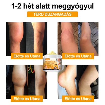 🐝🔥𝐈𝐳𝐮̈𝐥𝐞𝐭𝐢𝐕𝐢𝐭𝐚𝐥™ 𝐌𝐞́𝐡 𝐌𝐞́𝐫𝐞𝐠 𝐈𝐳𝐮̈𝐥𝐞𝐭𝐢 𝐑𝐞𝐠𝐞𝐧𝐞𝐫𝐚́𝐥𝐨 𝐊𝐞𝐳𝐞𝐥𝐨̋ 𝐊𝐫𝐞́𝐦 (𝐔́𝐣-𝐙𝐞́𝐥𝐚𝐧𝐝𝐢 𝐌𝐞́𝐡 𝐊𝐢𝐯𝐨𝐧𝐚𝐭 - 𝐒𝐳𝐚𝐤𝐨𝐬𝐨𝐝𝐢𝐤 𝐨𝐫𝐭𝐨𝐩𝐞́𝐝 𝐛𝐞𝐭𝐞𝐠𝐬𝐞́𝐠𝐞𝐤𝐫𝐞 𝐞́𝐬 𝐢𝐳𝐮̈𝐥𝐞𝐭𝐢 𝐟𝐚́𝐣𝐝𝐚𝐥𝐨𝐦𝐫𝐚)