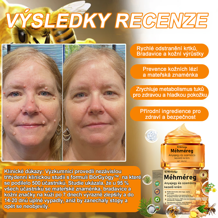 🎉🎉 Gratulálunk, hogy az első 200 rendelés egyike lettél! Élvezd az extra 50% kedvezményt! Cselekedj most, és őrizd meg bőröd egészségét. Ha most lemaradsz, csak jövőre lesz újabb lehetőség!