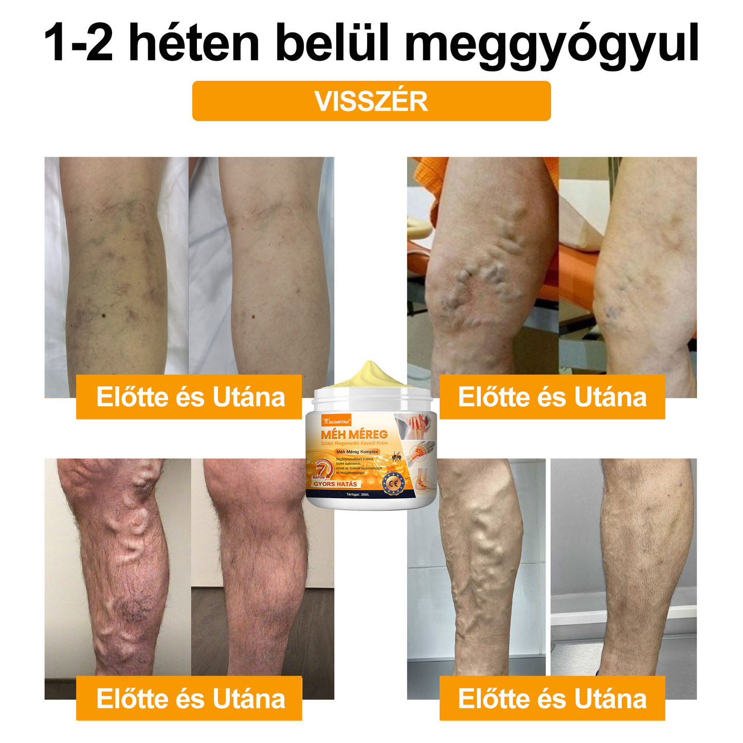 🐝🔥𝐈𝐳𝐮̈𝐥𝐞𝐭𝐢𝐕𝐢𝐭𝐚𝐥™ 𝐌𝐞́𝐡 𝐌𝐞́𝐫𝐞𝐠 𝐈𝐳𝐮̈𝐥𝐞𝐭𝐢 𝐑𝐞𝐠𝐞𝐧𝐞𝐫𝐚́𝐥𝐨 𝐊𝐞𝐳𝐞𝐥𝐨̋ 𝐊𝐫𝐞́𝐦 (𝐔́𝐣-𝐙𝐞́𝐥𝐚𝐧𝐝𝐢 𝐌𝐞́𝐡 𝐊𝐢𝐯𝐨𝐧𝐚𝐭 - 𝐒𝐳𝐚𝐤𝐨𝐬𝐨𝐝𝐢𝐤 𝐨𝐫𝐭𝐨𝐩𝐞́𝐝 𝐛𝐞𝐭𝐞𝐠𝐬𝐞́𝐠𝐞𝐤𝐫𝐞 𝐞́𝐬 𝐢𝐳𝐮̈𝐥𝐞𝐭𝐢 𝐟𝐚́𝐣𝐝𝐚𝐥𝐨𝐦𝐫𝐚)