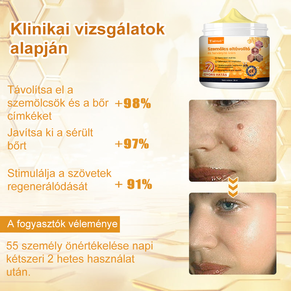 🌼GŐYUIŐ™ Szemölcs eltávolító és halványító krém🍯 4-6 héten belül teljesen eltávolítja a bőrcímkéket, szemölcsöket, pattanásokat és bőrpírt, klinikailag igazolt👩🏼‍⚕️ (Bőrgyógyászok erősen ajánlják)
