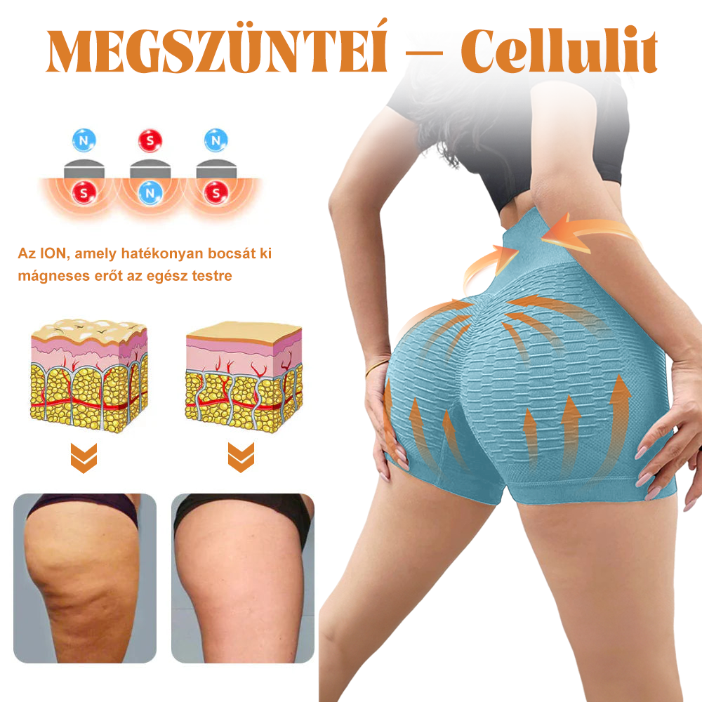⚜️⚜️【2024 őszi újdonság】]Iontartalmú mikro-vibrációs masszázsformáló rövidnadrág （⭐Formázás⭐Terhességi csíkok eltávolítása⭐Narancsbőr eltávolítása）