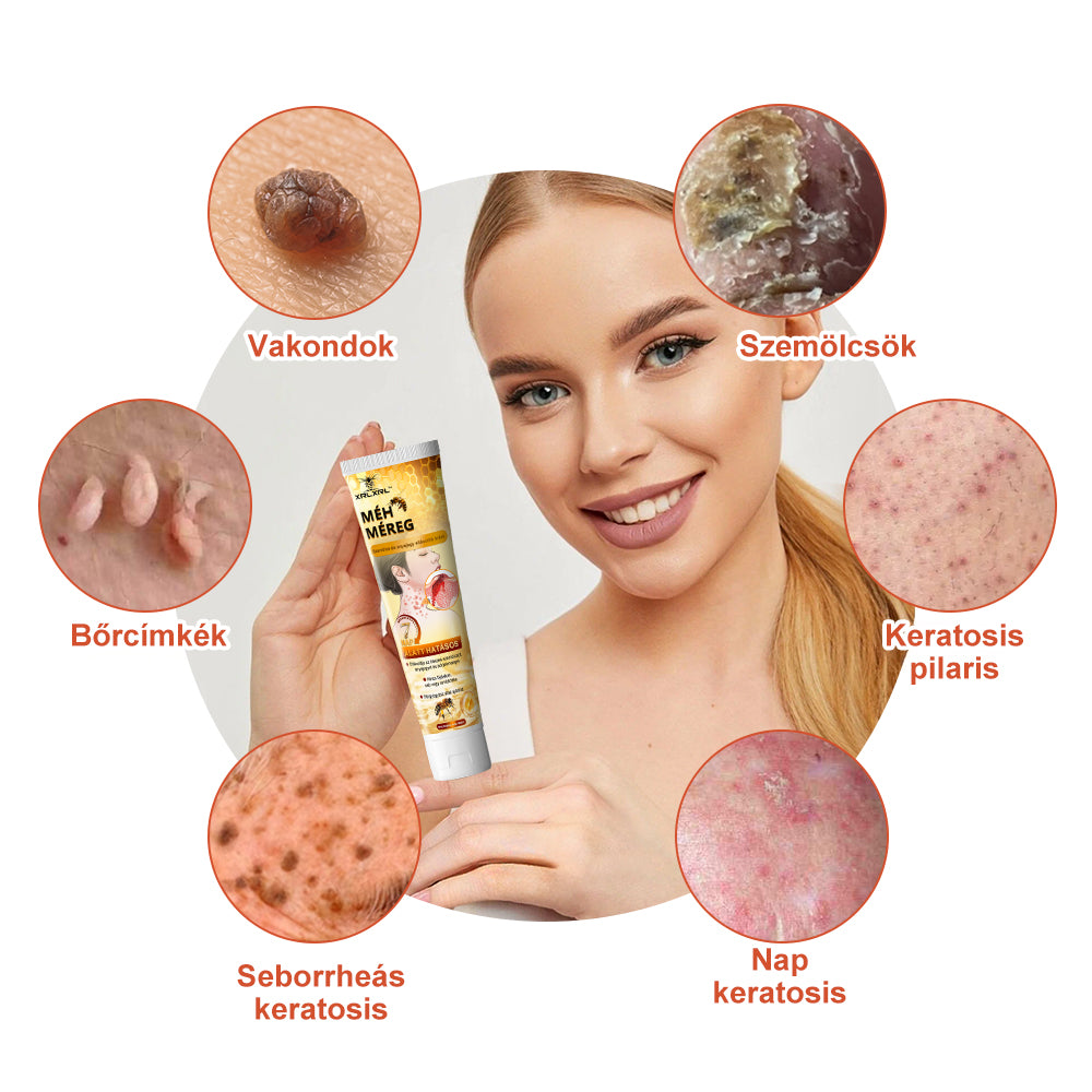 🎁 Csak még 5 doboz van hátra! Extra 50% kedvezményt kínálunk Önnek! Tartsa bőrét egészségesen. Most javítsa meg, különben csak jövőre lesz rá lehetőség.