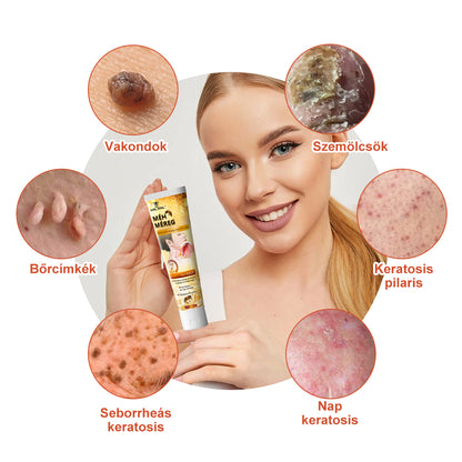 🎁 Csak még 5 doboz van hátra! Extra 50% kedvezményt kínálunk Önnek! Tartsa bőrét egészségesen. Most javítsa meg, különben csak jövőre lesz rá lehetőség.